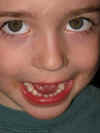 loose tooth.jpg (63820 bytes)