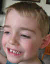 missing tooth.jpg (64270 bytes)