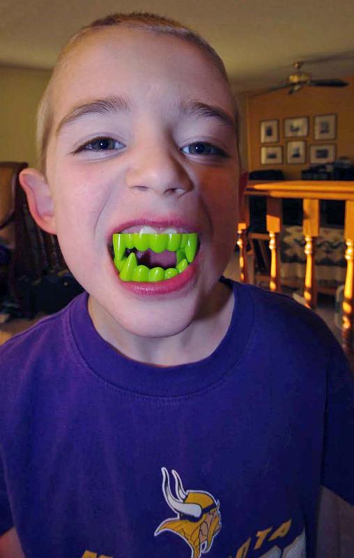 Green_Teeth.JPG