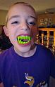 Green_Teeth